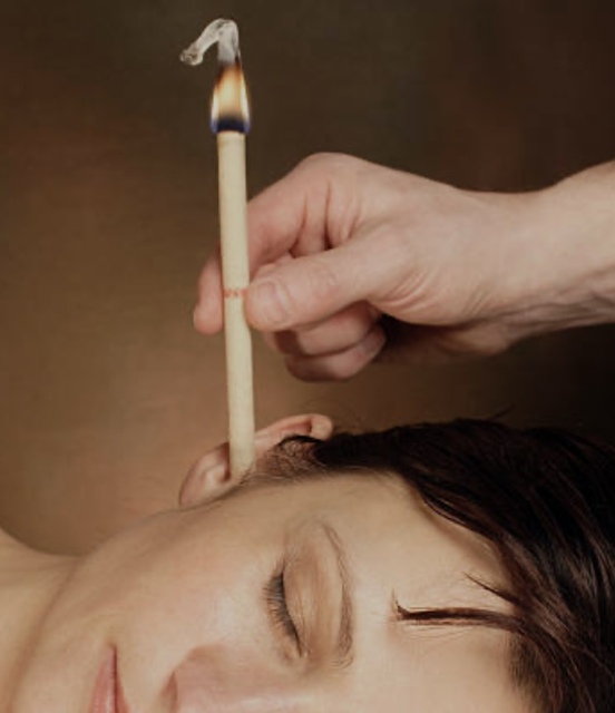 EAR CANDLING